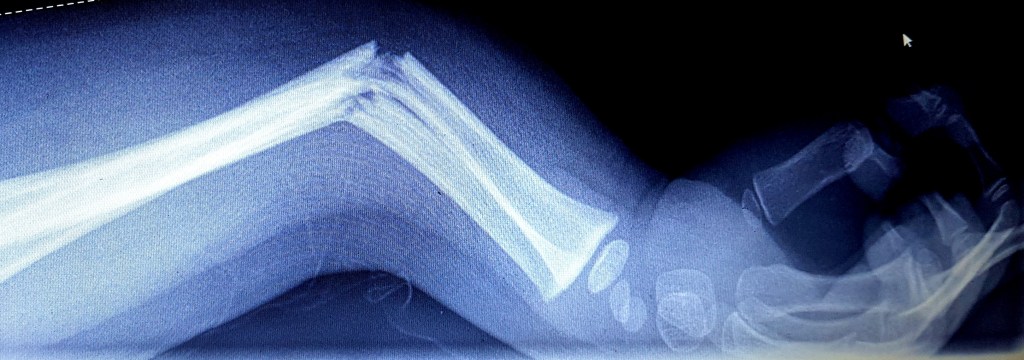 Ik kan hem wel&nbsp;vermóórden!